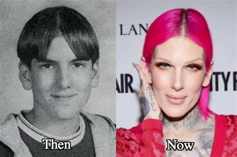 jeffree star before and after.